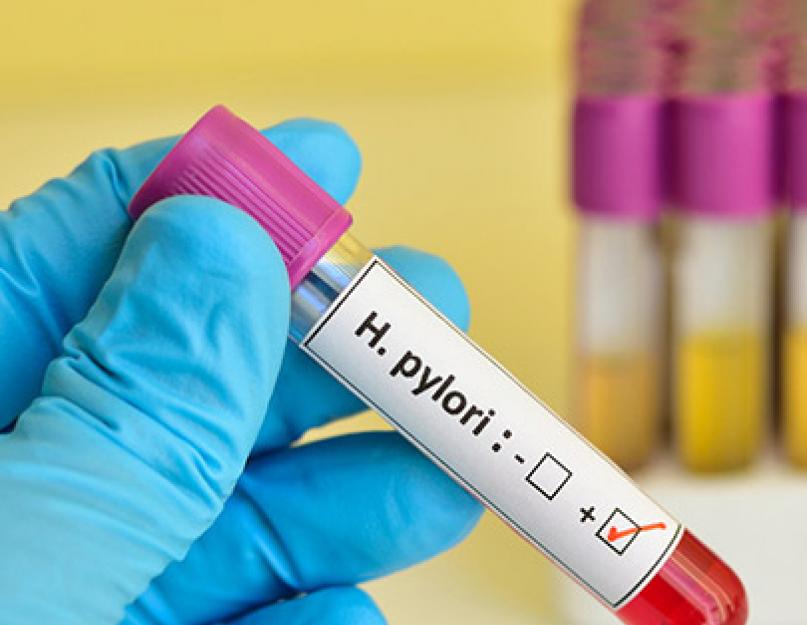 Hogyan kezelhető a Helicobacter pylori-fertőzés? - HáziPatika